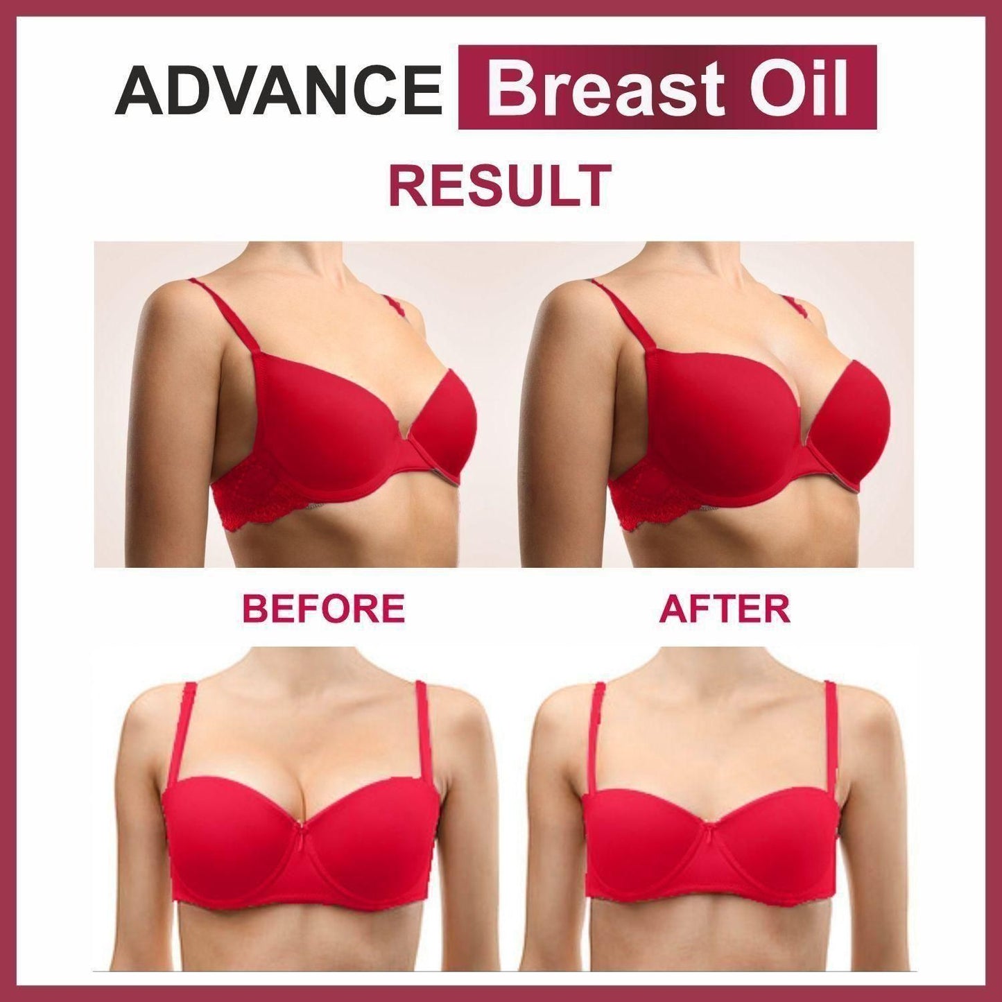 Oilanic Advance Breast Oil Combo 30ml Each (60ml) (Pack Of 2)